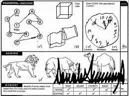 People with mild clock scoring criteria from the moca c lock drawing accounts for 3 of the 30 total moca points (10% of score). Curiosity About Trump S Cognitive Test May Skew Patients Results Medpage Today