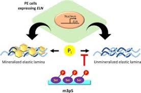 Kutatási területe a vállalatgazdaságtan, a versenyképesség és a logisztika. Elastin Calcification In In Vitro Models And Its Prevention By Mgp S N Terminal Peptide Sciencedirect