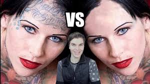 As science is progressing, tattoo removal has gained immense popularity. Tattoo Removal Before And After Youtube