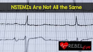 Nstemi is a partially blocked artery while stemi happens when the whole artery is blocked causing a part of the heart to die off.â â Nstemis Are Not All The Same Rebel Em Emergency Medicine Blog