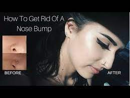How To Get Rid A Nose Bump In One Week Update Youtube Nose Piercing Bump Piercing Bump Nose