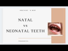Image result for Neonatal Teeth