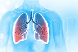 Image result for Acute Bronchitis
