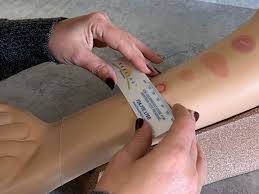 Nearly 4500 people lose their lives and 30 000 tb is contagious and airborne. Mantoux Tuberculin Skin Testing Rulers Breathe Pa