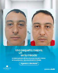 💎Soy el Dr. Frank Rojo, cirujano estético apasionado por mejorar la  confianza y autoestima de mis pacientes. Con técnicas de vanguardia y un  enfoque personalizado, cada resultado es natural y armonioso. 🔹