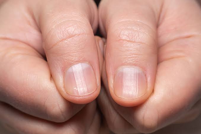 Harvard genetics professor shares what your fingernails say about your  'biological age' - The Mirror