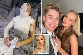 Aj pritchard has admitted he is traumatised after his girlfriend abbie's terrifying burn accident. 9rbmwc8d3xxism