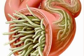 Acabe Con Los Parasitos Intestinales