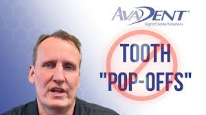 🎥🦷 Get ready for the next video in "Dentures with Devon!" Join AvaDent's  GM, Devon Howe, as he dives into the world of Tooth Pop-offs in our latest  series. 😁👨‍⚕️ Stay tuned for expert advice and ...