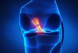 This is simply not the case. Torn Acl Symptoms Recovery Times Surgery Women
