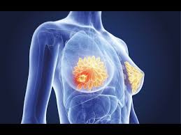 Mama yao, zainab bibi, ameiambia bbc ni furaha yake kwamba umefika wakati wa kuwapeleka watoto hao nyumbani kuendelea na maisha yao kama kawaida. Christopher Mwahangila Mapacha Wa Yesu Rudi Nyumbani Youtube