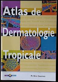Dermatologie Tlcharger Tropicale Gratuit Livre Atlas Ebook Pdf Detelecharger Livre Atlas De Dermatologie Tropicale Pdf Ebo Pdf Books Audio Books Books