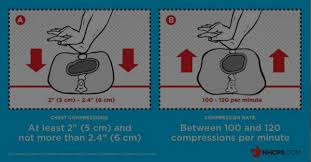Cpr Key Changes In 2015 Ilcor Guidelines Update