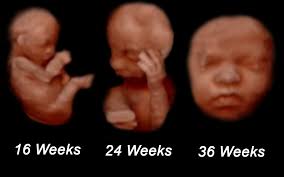Check spelling or type a new query. Comparison Of 2d 3d And 4d Ultrasound Technology Dailyscrawl