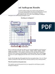 We did not find results for: How To Read Audiogram Results Hearing Loss Medical