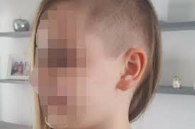 One of the negative consequences of the prospect of hair loss is also often the reason for refusing to complete treatment, which involves. At 8 She Shaved Part Of Her Hair For A Particular Reason Here S What This Little Girl Did Ruetir