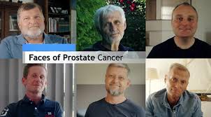 The urethra is the passage the carries urine from your bladder out of your body. Q A With Faces Of Prostate Cancer Director Keld Von Eyben Prostate Cancer Foundation