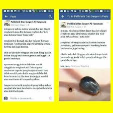 Information and translations of terkoyak in the most comprehensive dictionary definitions resource on the web. Awesome Spray Photos Facebook