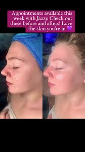 Jazzy has appointments available for this week. Love the skin you’re in 💜 