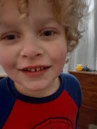 Importance of understanding autism in children