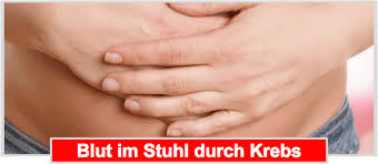 Verschiedene ursachen können zu blut im stuhl und bauchschmerzen führen. Warnung á… Blut Im Stuhl Direkt Zum Arzt Oder Abwarten