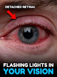 Image result for Light Flashes