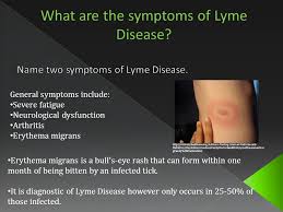 Borrelia burgdorferi is a stealth microbe that insidiously makes people chronically miserable, often for a lifetime. Borrelia Burgdorferi The Causative Agent Of Lyme Disease Is A Gram Negative Spirochete Discovered By Willy Burgdorfer Bacterial And Parasitic Co Infections Ppt Download
