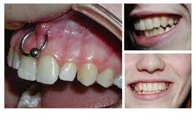 10 Painful Gum Piercings Gum Piercing Cool Nail Art Piercings
