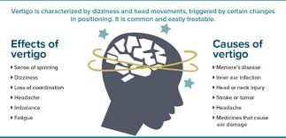 Image result for Vertigo Management