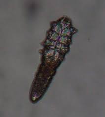 Image result for Demodex folliculorum