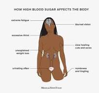 High blood sugar (hyperglycemia): Symptoms and more