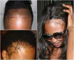 Hair Care Whilst Wearing Extensions The Pros And Cons Of Hair Extensions Part 1 Rehairducation