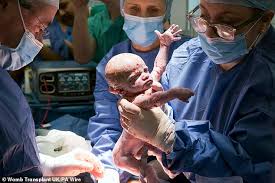 British woman becomes first in the country to give birth to a baby after a womb  transplant - and names her miracle daughter after sister who donated organ  | Daily Mail Online