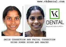 Orthodontically Corrected Lower Jaw And Teeth Vk Dental Clinic Dental Best Dentist Dental Clinic