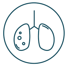 Different people have different symptoms for lung cancer, says the cdc. Lung Cancer Faq Learn About The Disease