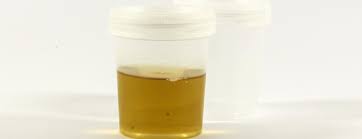 Black Specks In Urine Bladder Cancer Signs And Symptoms