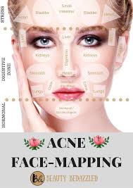 Acne Face Mapping What Does Your Acne Tell You Acne Face Map Female Pimples On Cheeks Meaning Pimples On Cheek Face Mapping Acne Face Acne Face Mapping