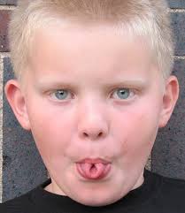 Image result for examples of genetic variation in humans