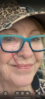 How many of these do I need to make a syrup? 😅