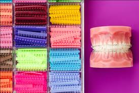 Maybe you would like to learn more about one of these? Pakai Braces Akhirnya