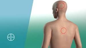 Wann aspirin zur gesundheitsgefahr wird. Aspirin Wie Wirkt Es Youtube