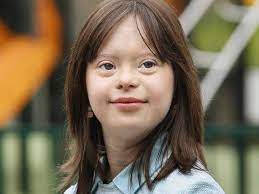 Középsúlyos értelmi fogyatékossággal és testi rendellenességekkel társul. Down Szindroma Kiderul Idojaras