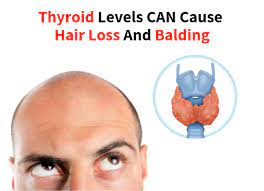 Thyroid hormones regulate our cell metabolism, so if something goes wrong, then it can have major implications our hair follicles are hypersensitive to sudden changes in hormone levels. Can Metformin Cause Thyroid