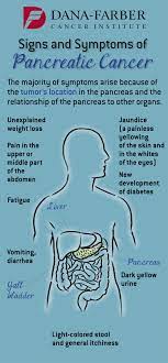 If you've been diagnosed with pancreatic cancer, ask your doctor which type you have. Pancreatic Cancer What Are The Signs And Symptoms Dana Farber Cancer Institute