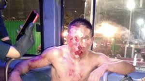 Hombre Golpeado En Pantitlan Contra Punto Noticias