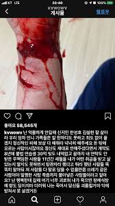 작성자 a 씨는 이날 공개된 권민아의 sns 사진 속 남성에 대해 내 친구랑 1,000일을 앞둔 시점에서 갑자기 남친이 연락이 뜸해지고 잠수타더니 권민아 계정에 럽스타가 올라왔다고 주장했는데요. ã„·ã„·ã„·aoa ë¯¼ì•„ ì†ëª© ê·¸ì—ˆë‹¤ ì§¤ë°© ìœ ë¨¸ê²Œì‹œíŒ ì¼ë² ì €ìž¥ì†Œ
