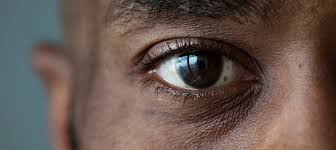 Seeing an Increase in Eye Floaters? See Your Eye Doctor | Duke Health