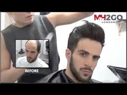 At hairplacenyc, we are committed to providing you with great hair. Hair Replacement Fitting Video Hair Loss Baldness Hair Wigs Hair Toupees Hair Pieces Youtube