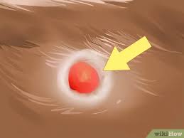The main cause of blood blisters is commonly the excessive pressure received by the affected area. How To Diagnose And Treat Blood Blisters In Cats 10 Steps