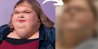 BOOM—Tammy just popped out with her first post-op pics and BABY… she might  be swollen, but that smile is LOUD. 😭🔥